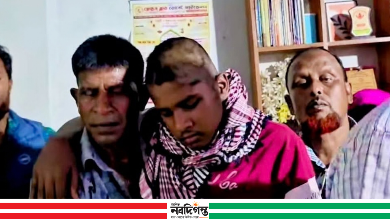 বগুড়ার শেরপুরে তুচ্ছ ঘটনাকে কেন্দ্র করে কিশোরকে রাতভর নির্যাতন
