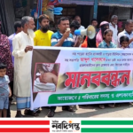 গড়েয়ায় স্বেচ্ছাসেবক দল নেতা খালেককে হত্যা চেষ্টার প্রতিবাদে মানববন্ধন