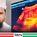 নেত্রকোনায় মাদরাসা ছাত্রীকে ধর্ষণ: শিক্ষক পলাতক, ৫ মাসের অন্তঃসত্ত্বা শিশুটির জীবন ঝুঁকিতে