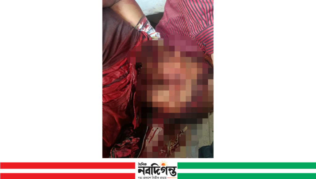 চিতলমারীতে কেনাবেচার বিরোধে দোকানি নিহত