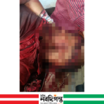 চিতলমারীতে কেনাবেচার বিরোধে দোকানি নিহত