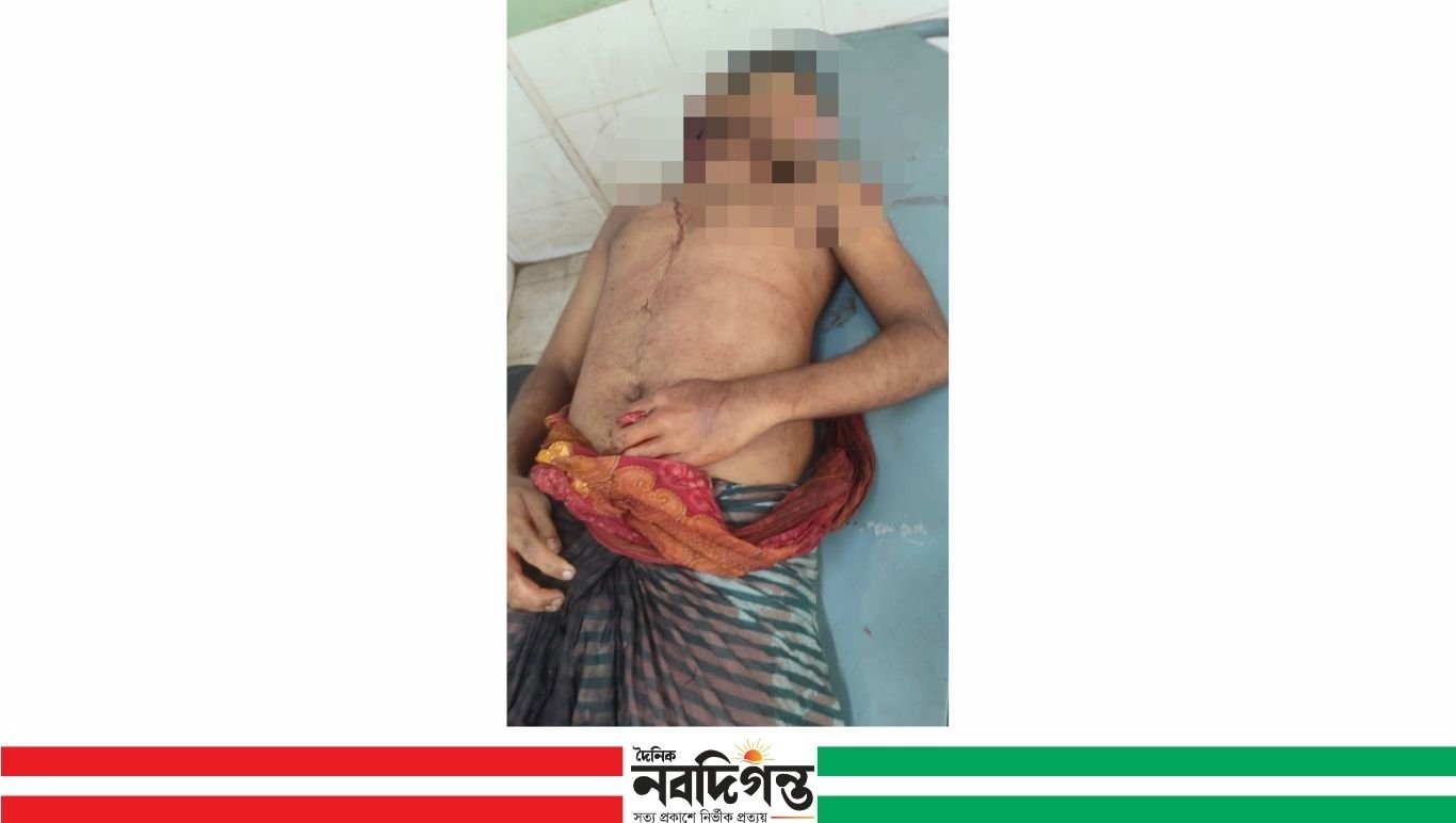 বাগেরহাটে ফুফাতো ভাইয়ের ছুরিকাঘাতে যুবকের মৃত্যু, আটক ১