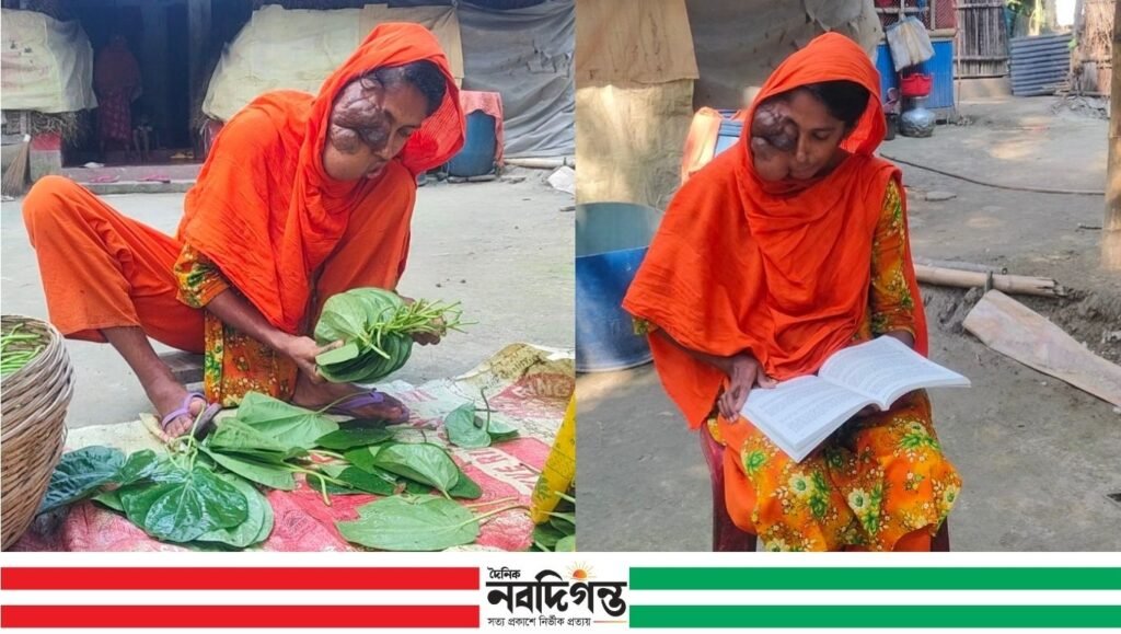টিউমারের সঙ্গে লড়েও স্বপ্ন দেখে রাবেয়া 1 টিউমারের সঙ্গে লড়েও স্বপ্ন দেখে রাবেয়া