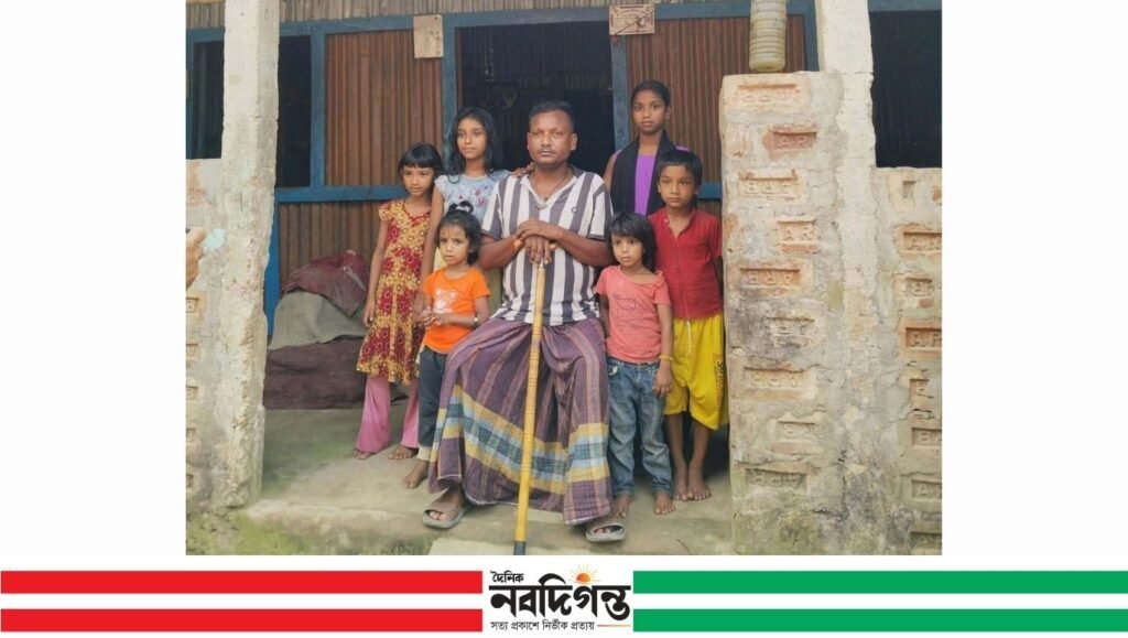 চিকিৎসার অভাবে অসহায় টমটম চালক শিপন 1 চিকিৎসার অভাবে অসহায় টমটম চালক শিপন