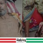 বিএনপির বিরুদ্ধে এক আ'লীগ কর্মীকে কুপিয়ে আহত করার অভিযোগ