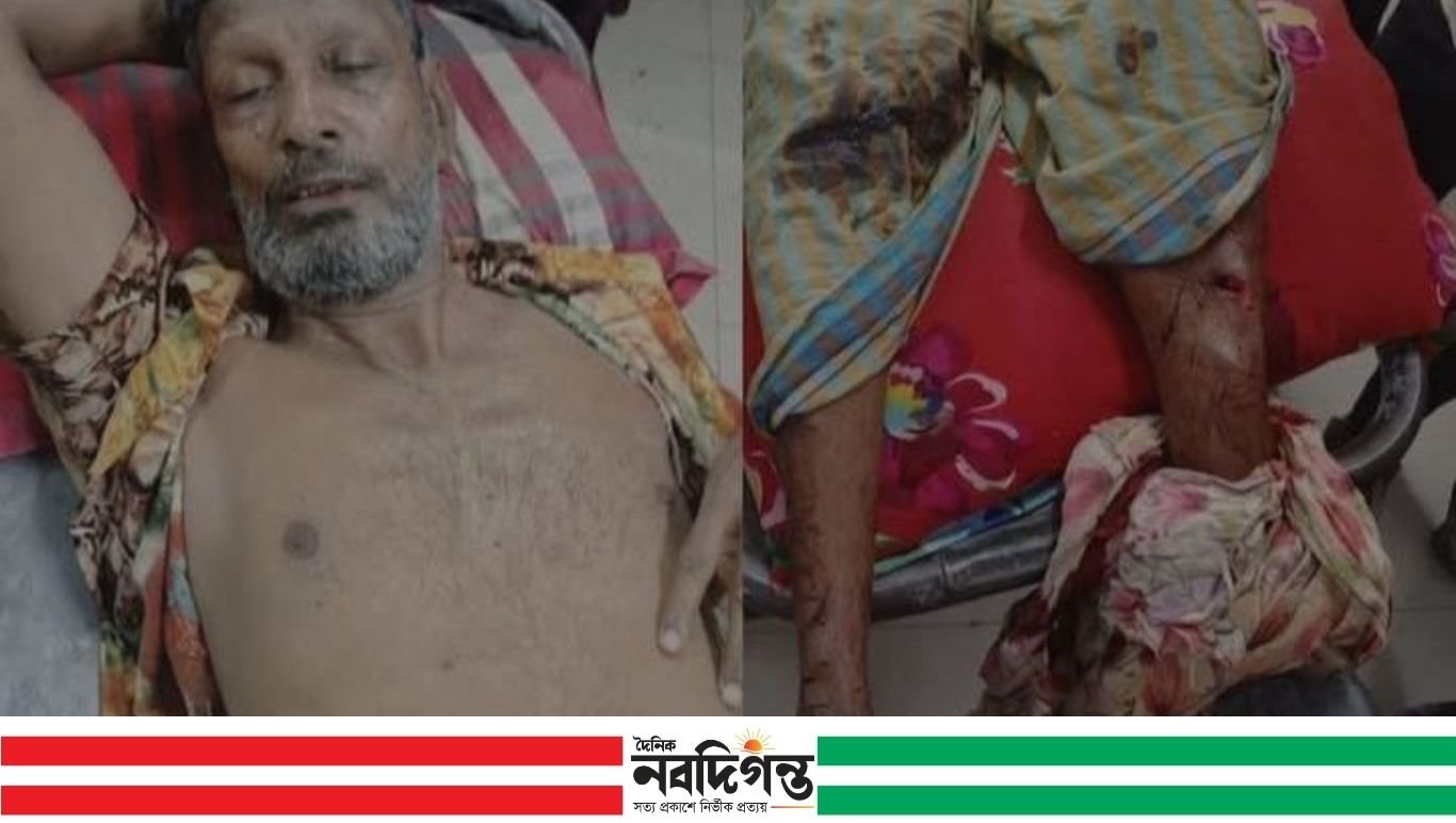 বিএনপির বিরুদ্ধে এক আ'লীগ কর্মীকে কুপিয়ে আহত করার অভিযোগ