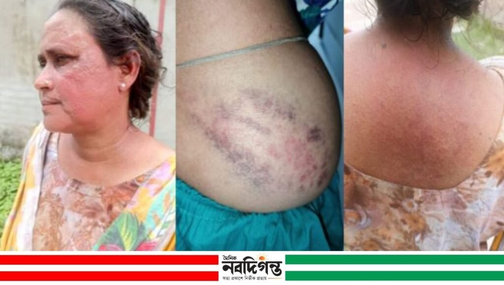 মোংলায় হামলার অভিযোগ: নারীসহ একই পরিবারের ৩ জন আহত, মামলা না নেওয়ার অভিযোগ