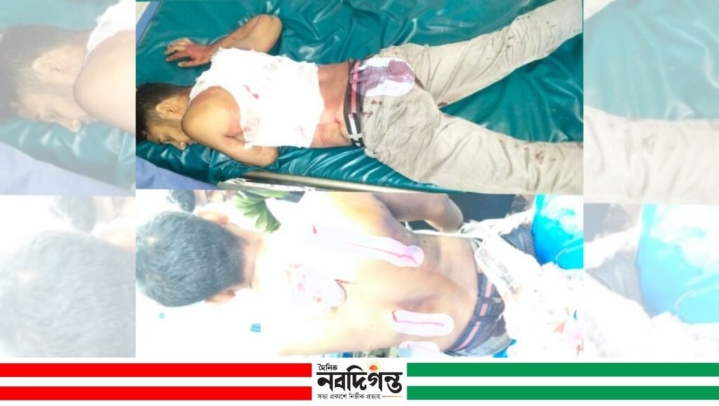 উপজেলা শহরে দুর্বৃত্তের ছুরিকাঘাতে গুরুতর আহত মুদি ব্যবসায়ী আবু বক্কর উপজেলা শহরে দুর্বৃত্তের ছুরিকাঘাতে গুরুতর আহত মুদি ব্যবসায়ী আবু বক্কর