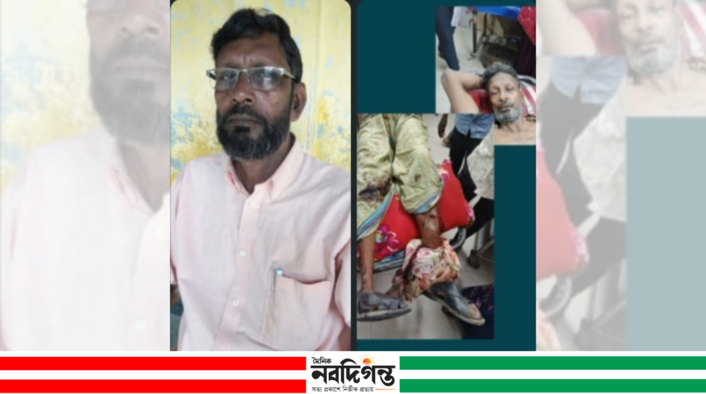 নলডাঙ্গায় হামলায় আহত নিষিদ্ধ আওয়ামী লীগ নেতার চিকিৎসাধীন অবস্থায় মৃত্যু