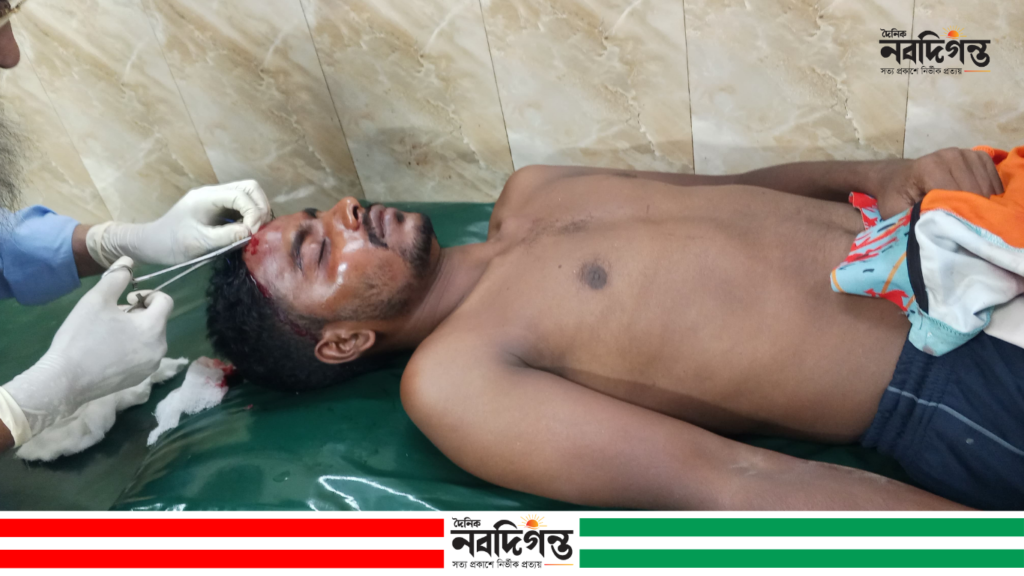 নলডাঙ্গায় ফুটবল খেলাকে কেন্দ্র করে সংঘর্ষ, যুবসংগঠন নেতা আহত নলডাঙ্গায় ফুটবল খেলাকে কেন্দ্র করে সংঘর্ষ, যুবসংগঠন নেতা আহত