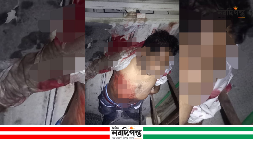 বাগেরহাটে দুর্বৃত্তের ছুরিকাঘাতে প্রাণ গেল আইনজীবীর