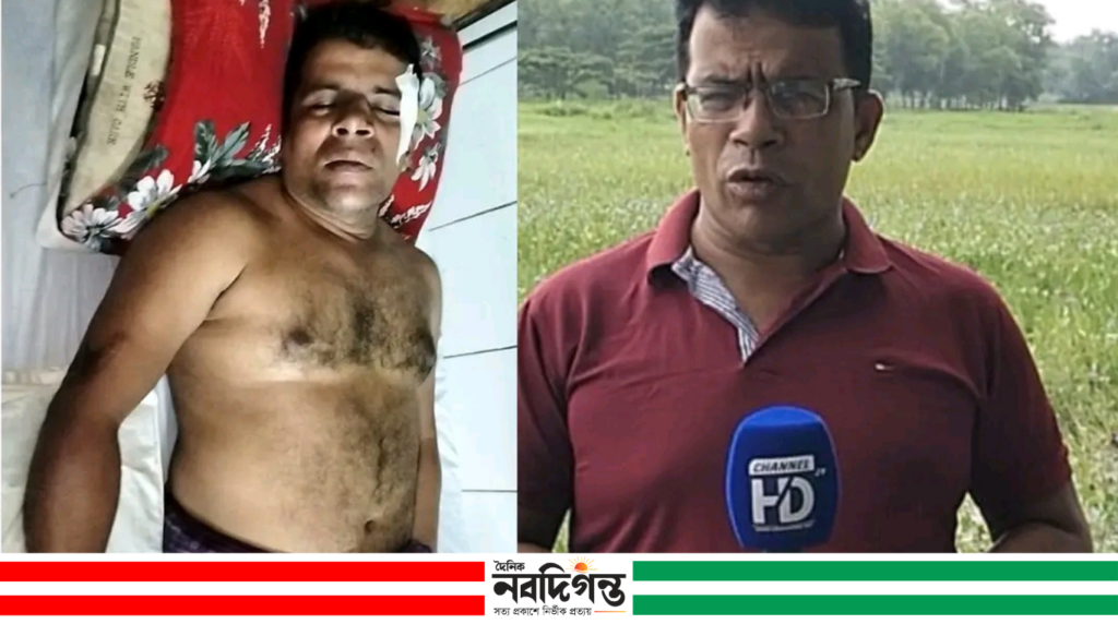 বুড়িচংয়ে মাদকবিরোধী সংবাদ প্রকাশের জেরে সাংবাদিক কিবরিয়া’র উপর হামলা বুড়িচংয়ে মাদকবিরোধী সংবাদ প্রকাশের জেরে সাংবাদিক কিবরিয়া'র উপর হামলা