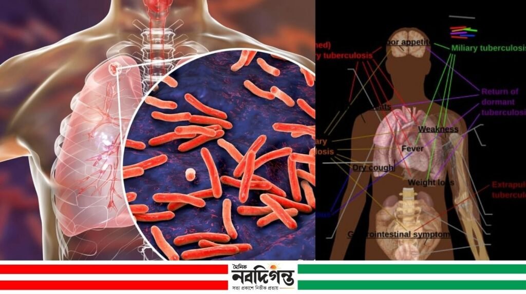 টিবি রোগ নির্ণয়ে আন্তর্জাতিক স্বীকৃতির পথে বাংলাদেশের ৬ রেফারেন্স ল্যাব