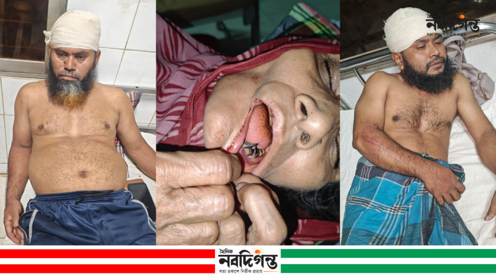 মাদারীপুরে সংঘর্ষের অভিযোগ: হামলা, ভাঙচুর ও লুটপাটে আহত ৪