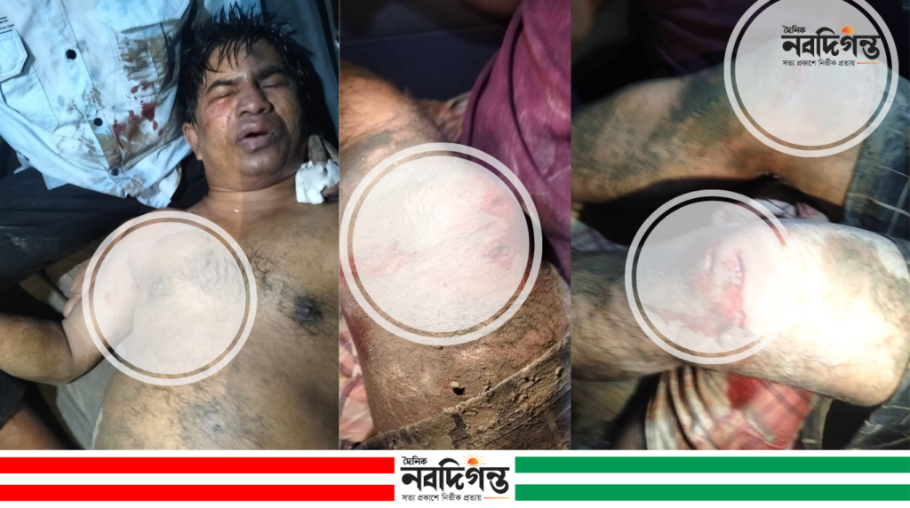 হ্নীলায় সাবেক ইউপি সদস্য ও সংবাদকর্মী জামাল উদ্দিনকে তুলে নিয়ে মারধরের অভিযোগ