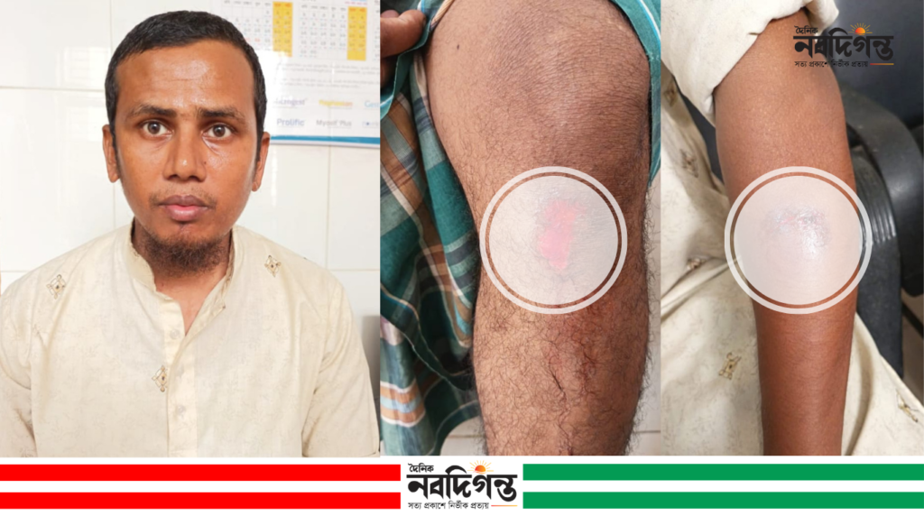 মাদারীপুরে আদালত প্রাঙ্গণ থেকে তুলে নিয়ে মারধর ও ছিনতাইয়ের অভিযোগ