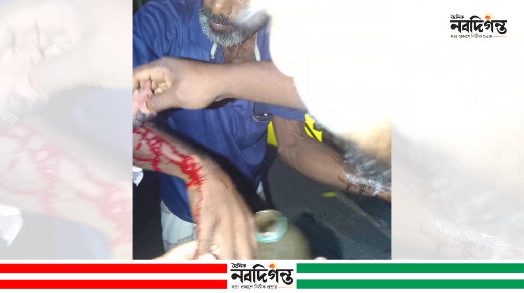 বোরহানউদ্দিনে ফেরিওয়ালার ওপর হামলার অভিযোগ, হাসপাতালে ভর্তি বোরহানউদ্দিনে ফেরিওয়ালার ওপর হামলার অভিযোগ, হাসপাতালে ভর্তি