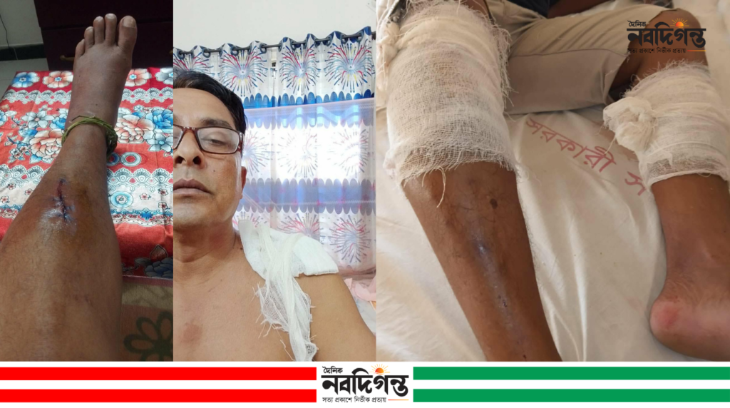 বালিয়াকান্দিতে মারপিট করে হত্যাচেষ্টার অভিযোগ, থানায় মামলা